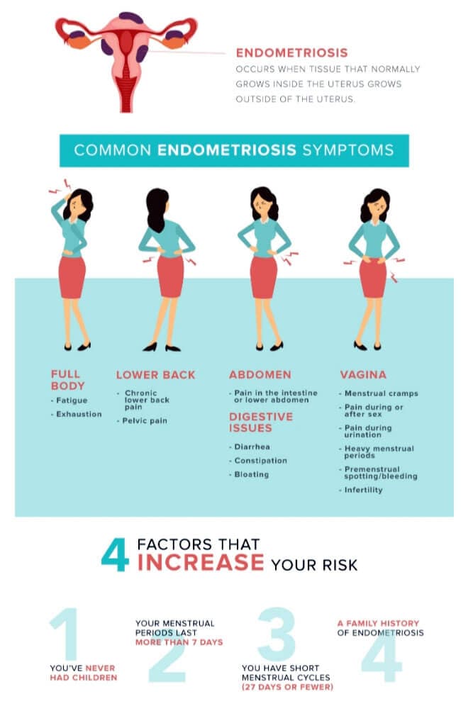 ENDOMETRIOSIS